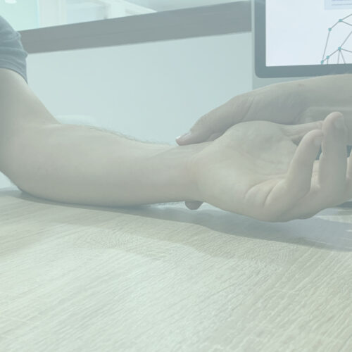 Síndrome del Túnel Carpiano: Fisioterapia y Prevención