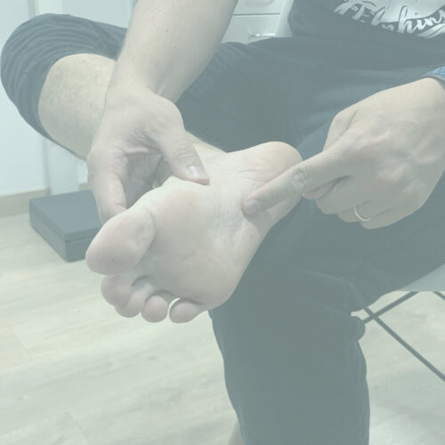 Fascitis Plantar: causas, síntomas y fisioterapia